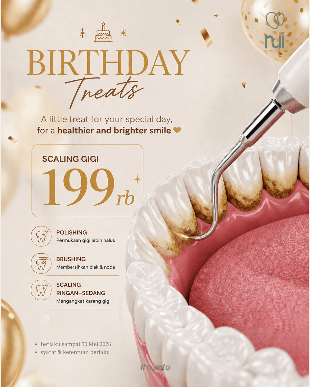 Birthday Treats — Scaling gigi 199rb
